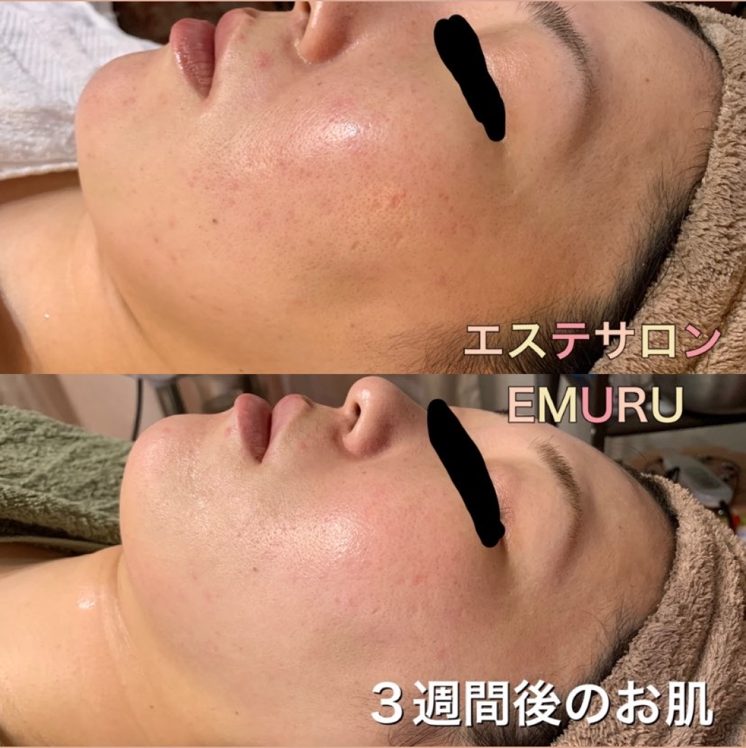 BeforeAfterイメージ