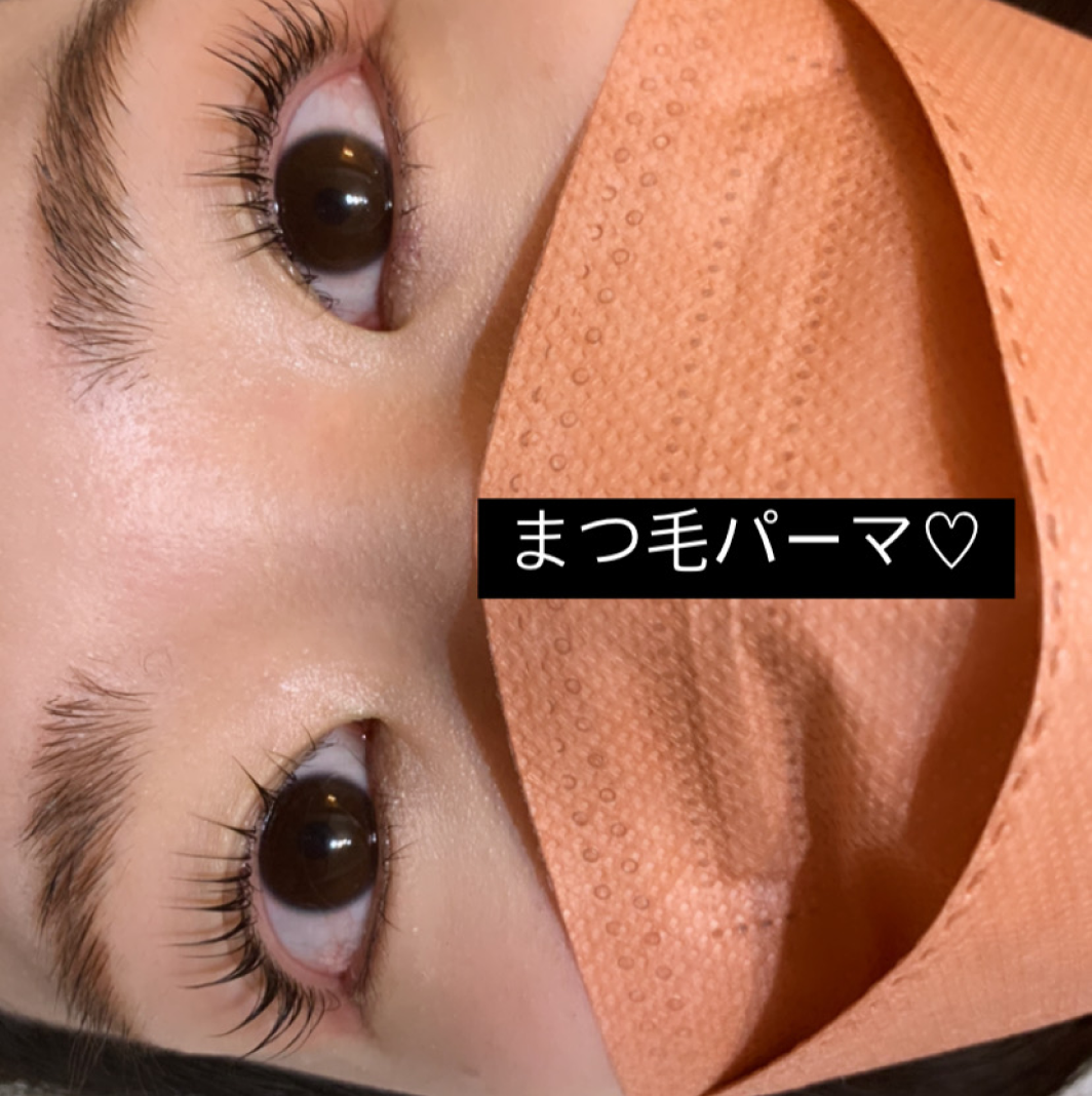 BeforeAfterイメージ
