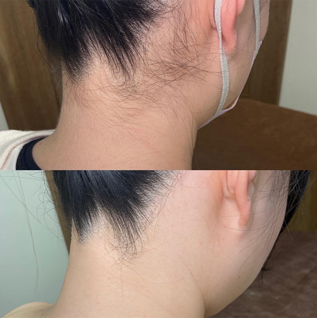 BeforeAfterイメージ