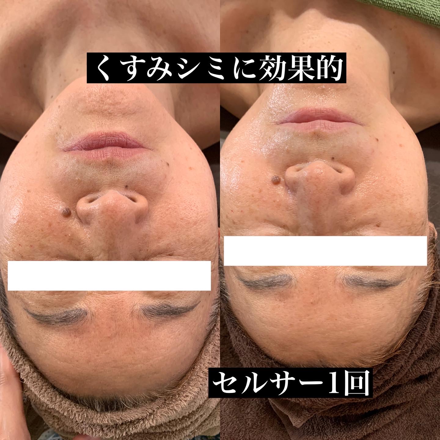 BeforeAfterイメージ