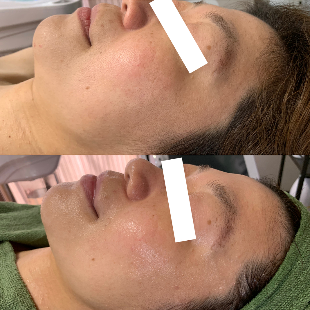 BeforeAfterイメージ